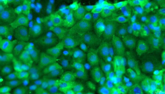 Primary Mouse Tubal Epithelial Cells (TuEC)