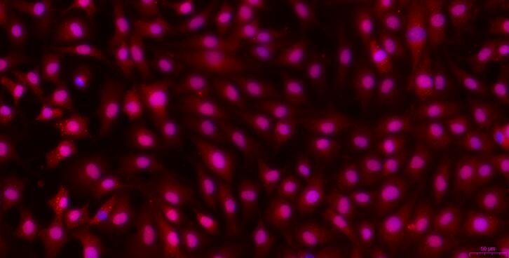 Primary Rabbit Tracheal Chondrocytes (TrC)