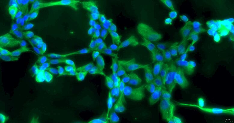 Primary Rabbit Parotid Fibroblasts (PaF)