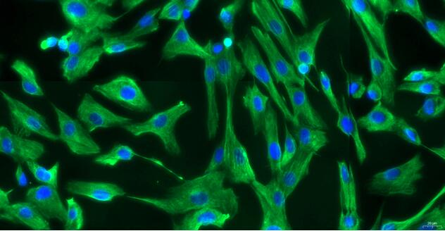 Primary Canine Cardiac Valve Interstitial Cells (CVIC)