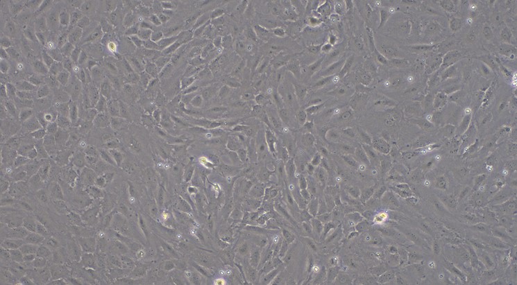 Primary Rat Cardiac Valve Interstitial Cells (CVIC)
