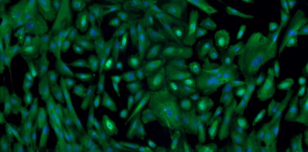 Primary Canine Pericardial Mesothelial Cells (PeMC)