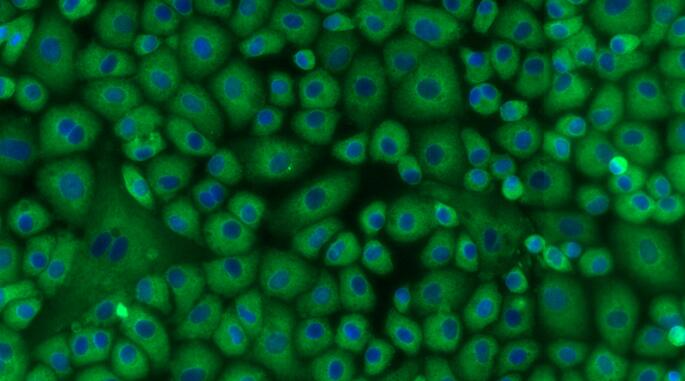 Primary Rat Pericardial Mesothelial Cells (PeMC)