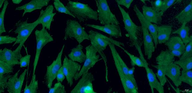 Primary Canine Vaginal Smooth Muscle Cells (VSMC)