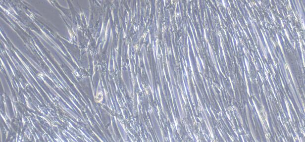 Primary Canine Inferior Vena Cava Smooth Muscle Cells ( IVCSMC)