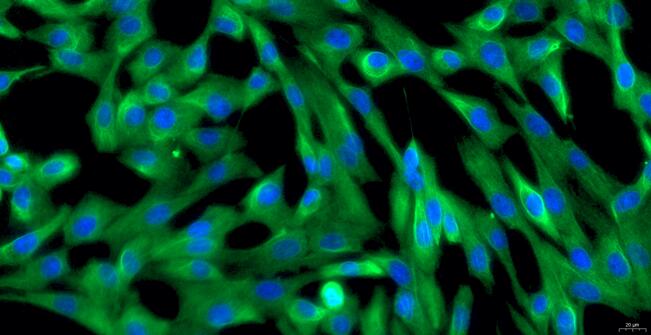 Primary Canine Endocardial Fibroblasts (EnCF)