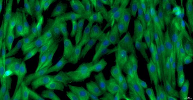 Primary Caprine Endocardial Fibroblasts (EnCF)