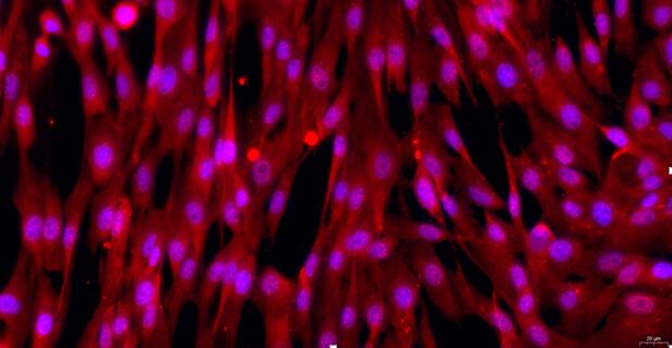 Primary Canine Epicardial Fibroblasts (EpCF)