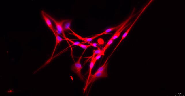 Primary Rat Dorsal Root Ganglion Neuron Cells (DRGN)