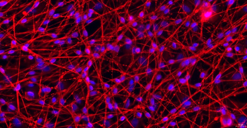 Primary Rat Dorsal Root Ganglion Neuron Cells (DRGN)