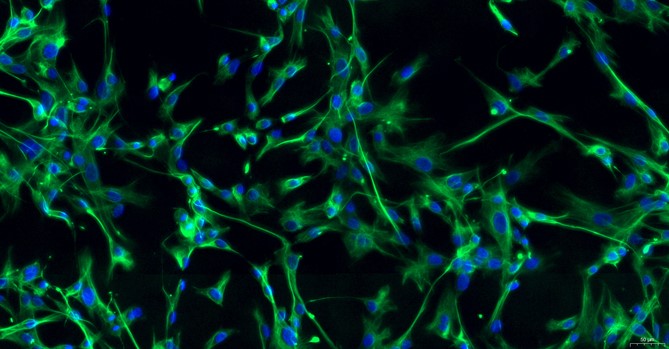 Primary Rabbit Aorta Adventitial Fibroblasts (AAF)