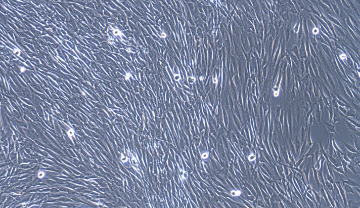 Primary Cavia Peripheral Sciatic Nerve Fibroblasts ( PSNC)