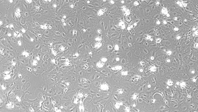 Primary Mouse Oral Mucosal Epithelial Cells ( OMEC)