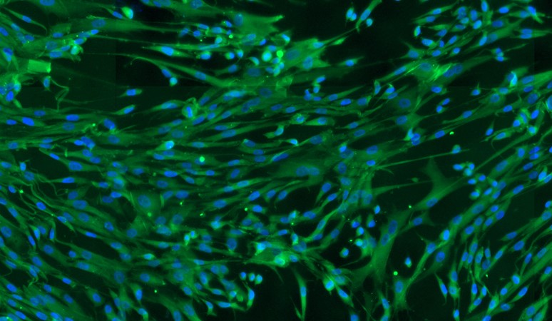 Primary Rat Dermal Vascular Smooth Muscle Cells (DVSMC)