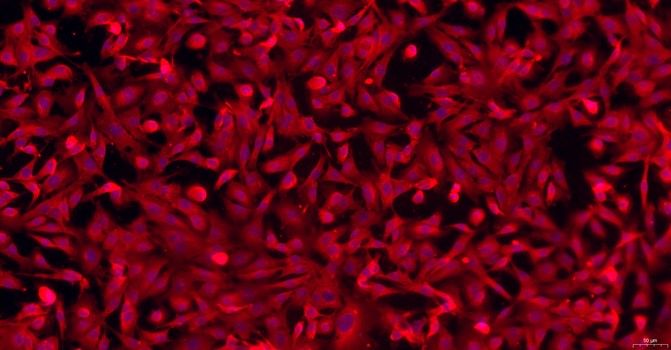 Primary Mouse Peritoneal Fibroblasts (PF)