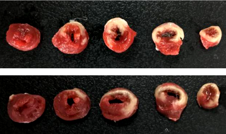 Rat Model for Myocardial Infarction (MI)