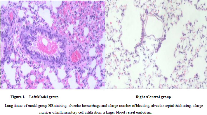 Mouse Model for Pulmonary Embolism (PE)