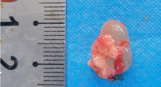 Rat Model for Endometriosis (EM)