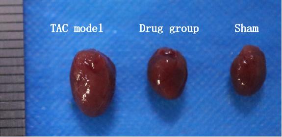 Mouse Model for Cardiac Hypertrophy (CH)