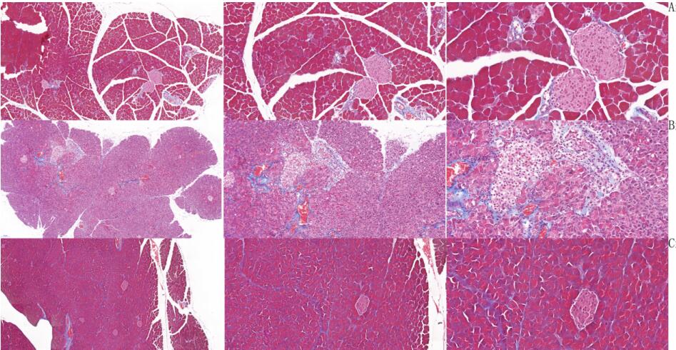 Mouse Model for Acute Pancreatitis (AP)