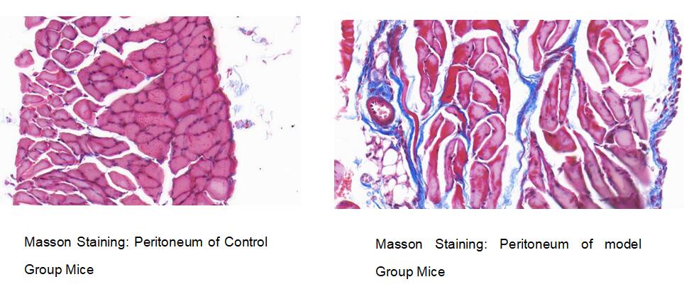 Mouse Model for Peritoneal Fibrosis (PF)