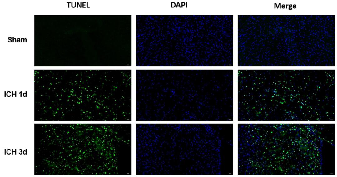 Mouse Model for Cerebral Hemorrhage (CH)