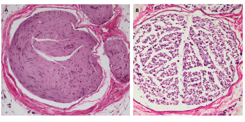 Rat Model for Sciatic Nerve Injury (SNI)