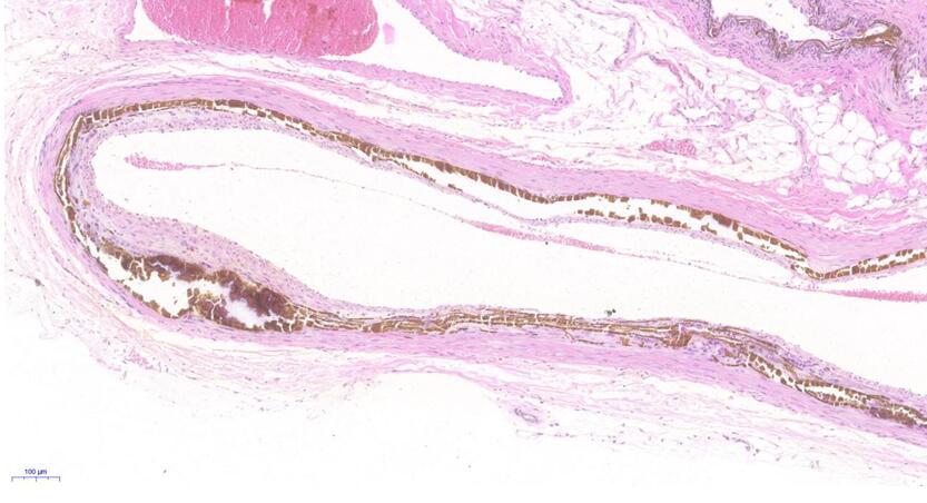 Rat Model for Vascular Calcification (VC)