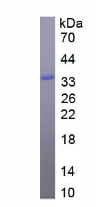 Eukaryotic Erythropoietin (EPO)