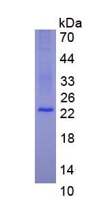 Eukaryotic Factor Related Apoptosis (FAS)