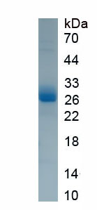 Eukaryotic Colony Stimulating Factor 3, Granulocyte (GCSF)