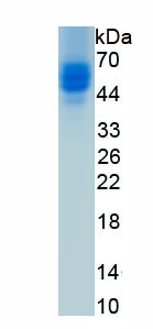 Eukaryotic Insulin Like Growth Factor Binding Protein 3 (IGFBP3)