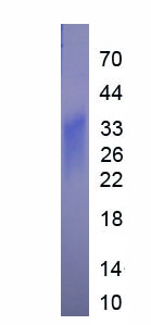 EPA060Hu62.jpg