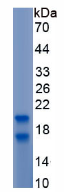 Eukaryotic Interleukin 2 (IL2)