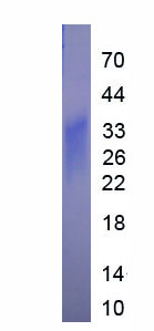 Eukaryotic Interleukin 3 (IL3)