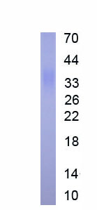 Eukaryotic Monocyte Chemotactic Protein 1 (MCP1)