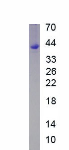 Eukaryotic Monocyte Chemotactic Protein 2 (MCP2)