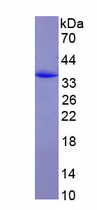 Eukaryotic Macrophage Derived Chemokine (MDC)