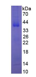 Eukaryotic Nerve Growth Factor (NGF)