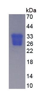 Eukaryotic Oncostatin M (OSM)