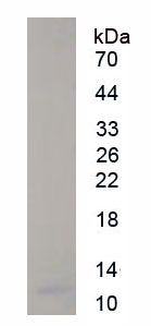 Eukaryotic Stromal Cell Derived Factor 1 (SDF1)