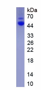 Eukaryotic Transforming Growth Factor Beta 1 (TGFb1)