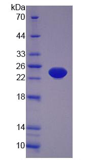 Eukaryotic Tumor Necrosis Factor Alpha (TNFa)