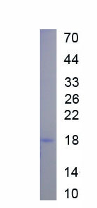 Eukaryotic Vascular Endothelial Growth Factor C (VEGFC)