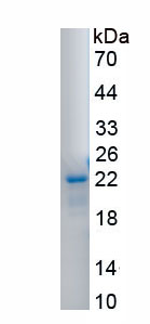 Eukaryotic Vascular Endothelial Growth Factor C (VEGFC)