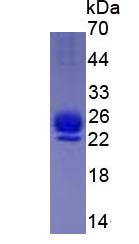 Eukaryotic Interleukin 1 Receptor Antagonist (IL1RA)