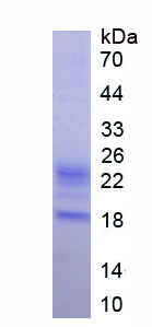 Eukaryotic WAP Four Disulfide Core Domain Protein 2 (WFDC2)