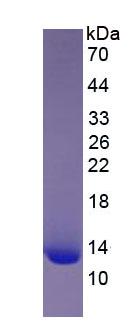 Eukaryotic Beta-2-Microglobulin (b2M)