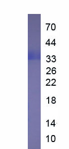 Eukaryotic Galectin 3 (GAL3)