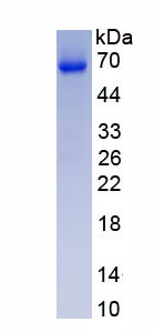 Eukaryotic High Mobility Group Protein 1 (HMGB1)